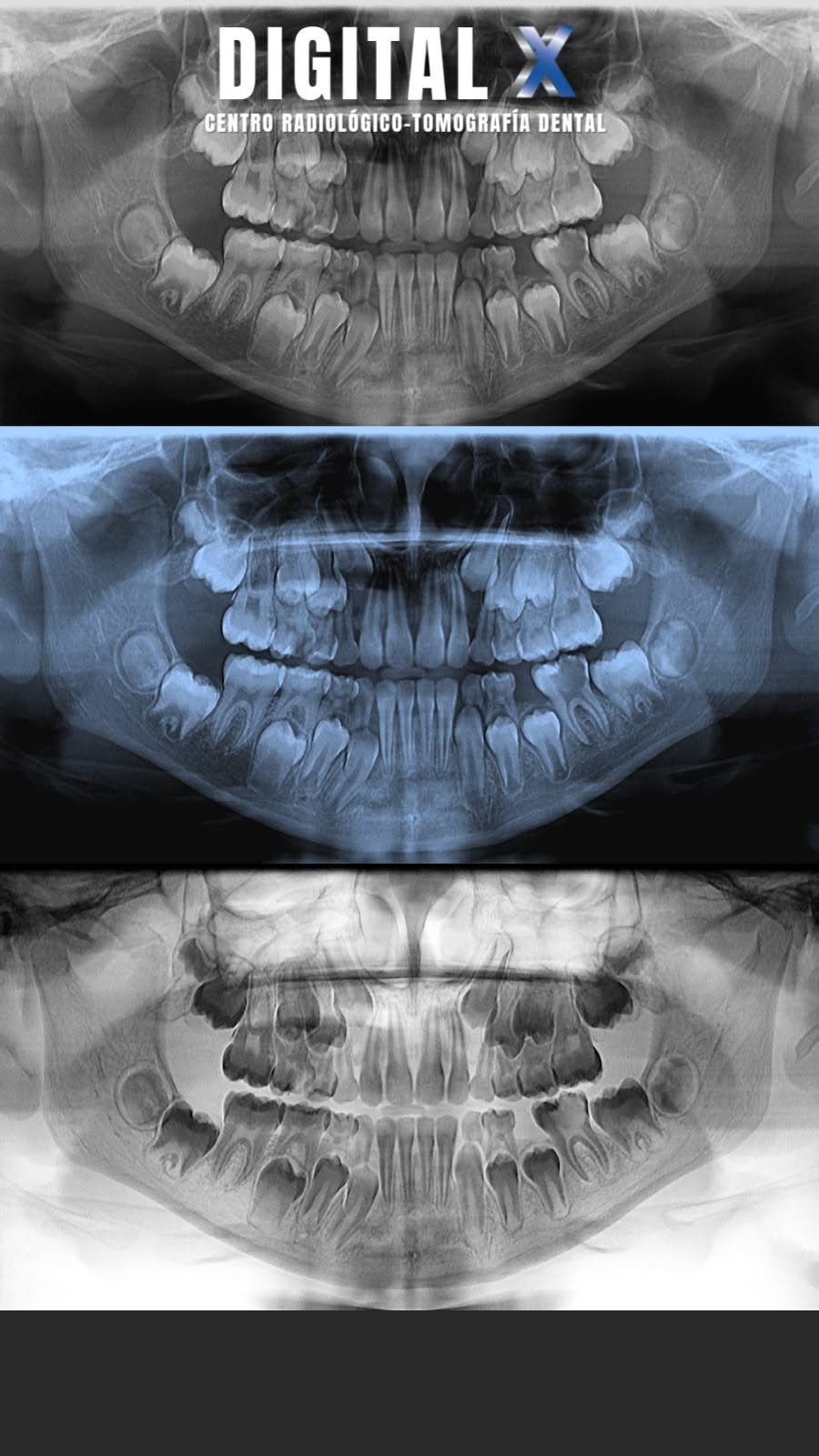 Tomografía 3D Smart Dent