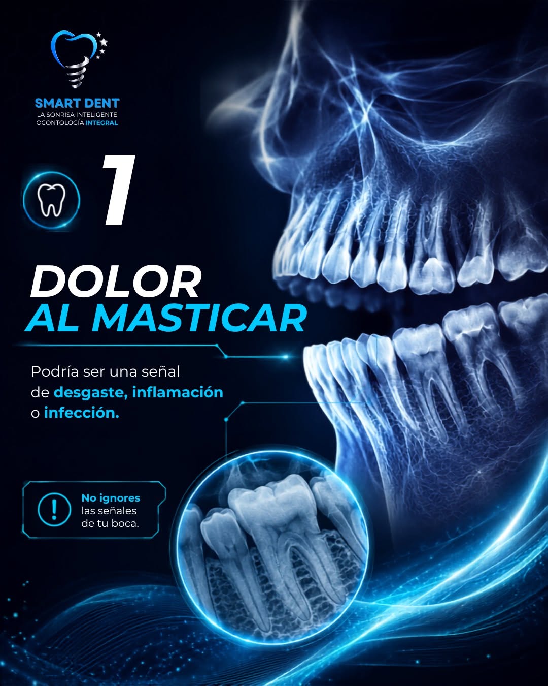 Implantes